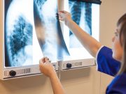 Что такое негатоскоп и для чего он используется