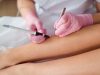 Электроэпиляция: секрет гладкой кожи на долгие годы