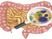Воспалительные заболевания кишечника увеличивают риск инсульта