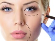 Контурная пластика: молодость и красота без скальпеля