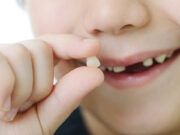 Как вырвать молочный зуб у ребенка