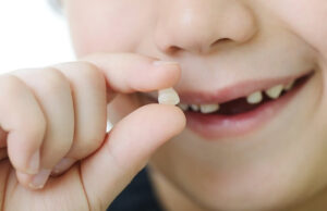 Как вырвать молочный зуб у ребенка