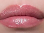 Увеличение губ: популярность, методы, плюсы и минусы