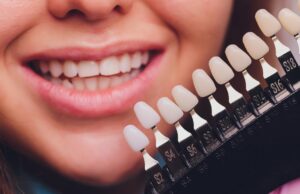 Новые виниры: идеальное решение для безупречной улыбки