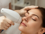 Лазерная эпиляция лица: как делают, сколько сеансов необходимо